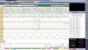 Reviewing Patient Records