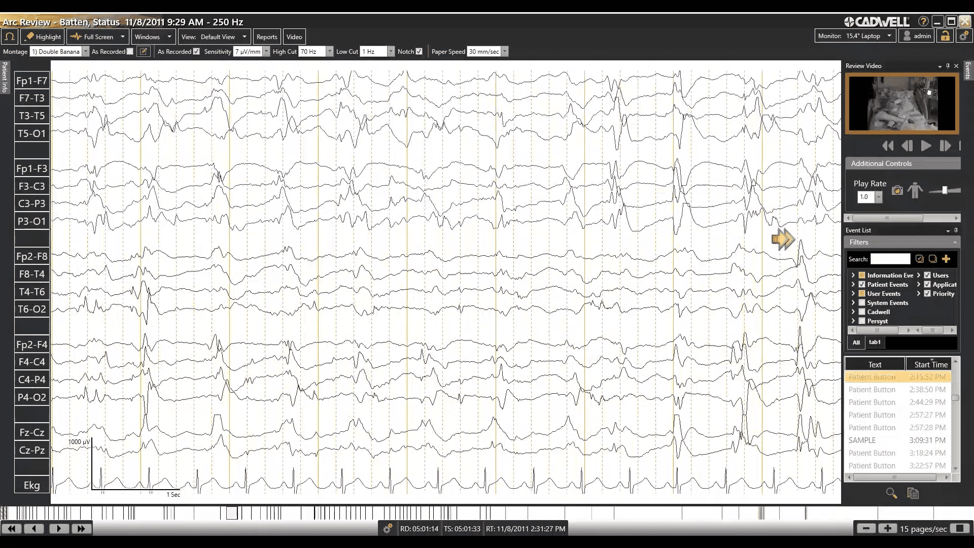 EEG Data Navigation