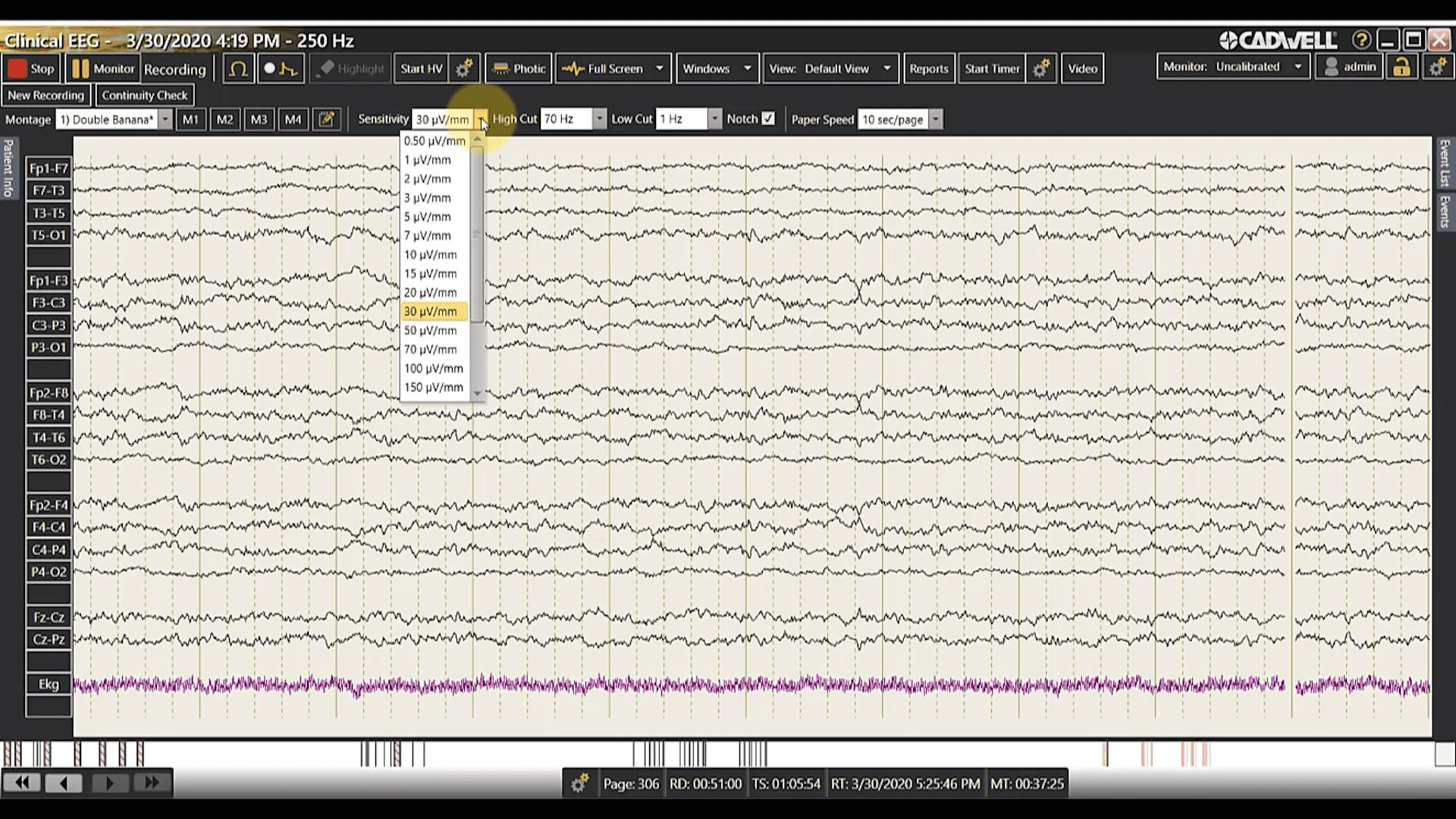 Adjusting Trace Sensitivity and Filters