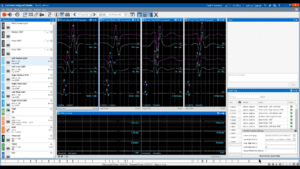 Timeline Enhancements