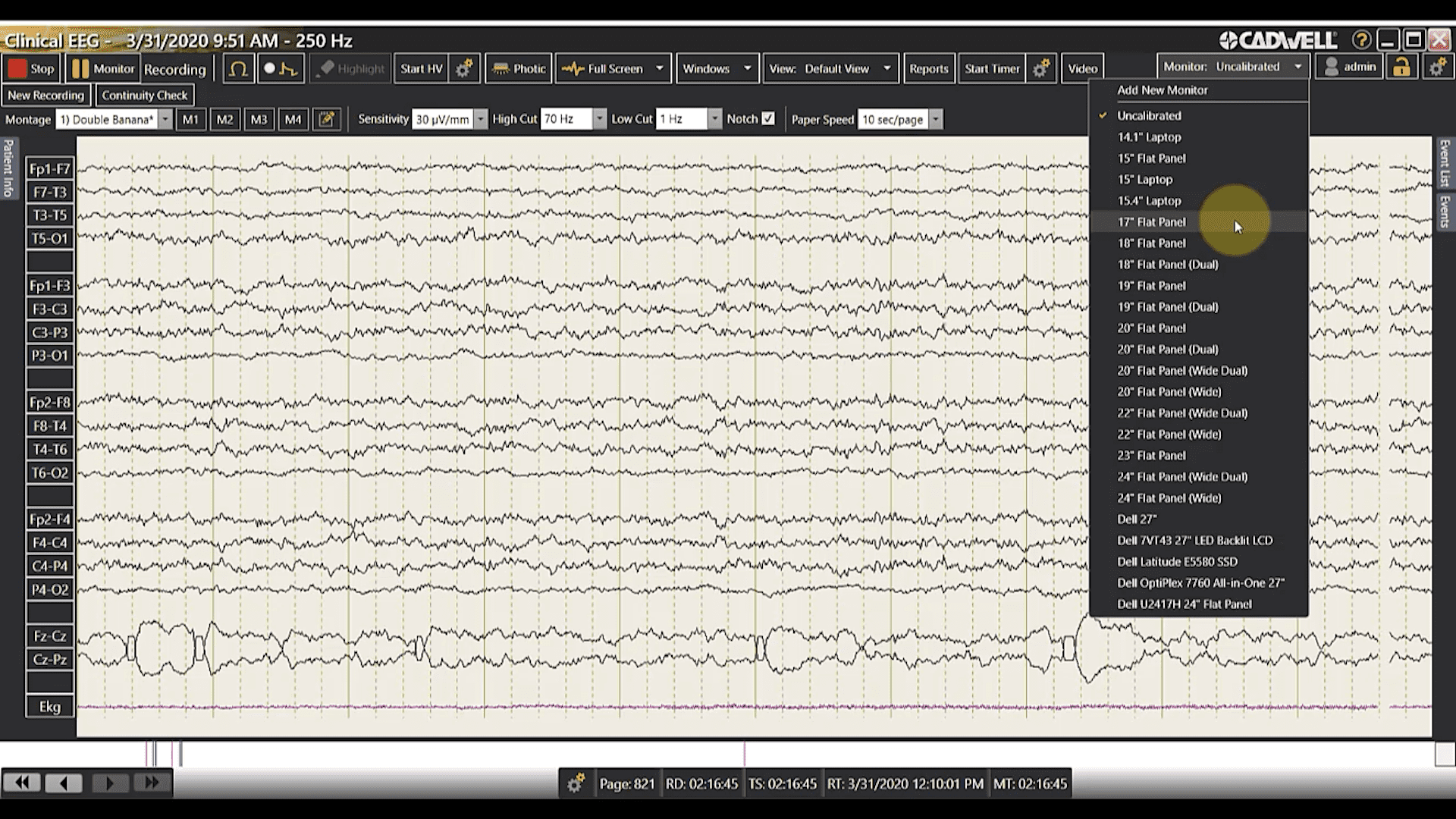 Calibrate Your Display
