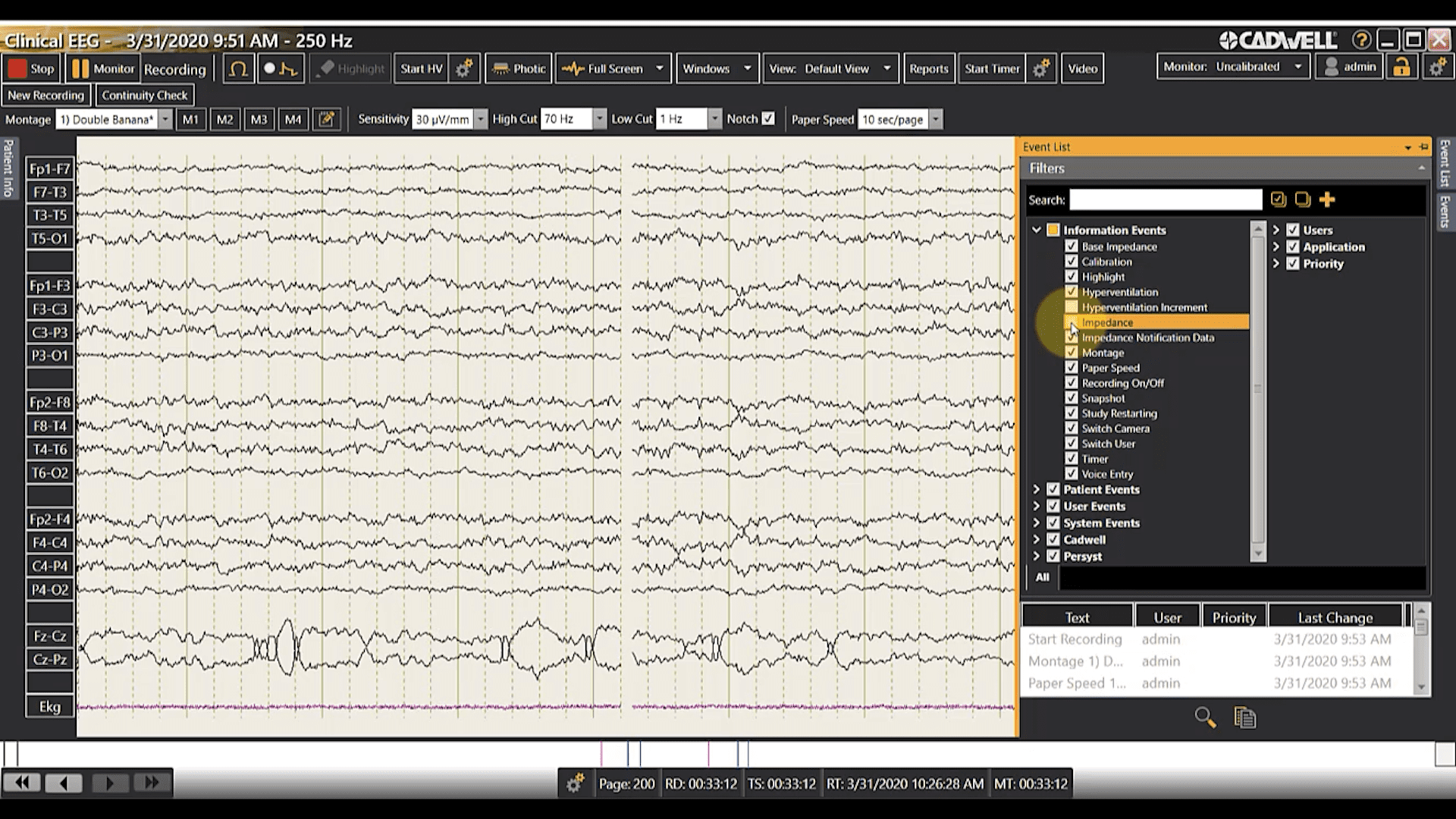 Event List During Acquisition