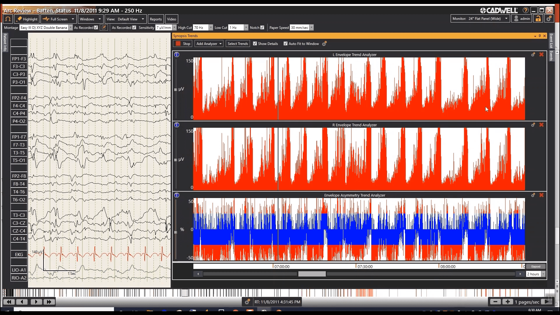 Envelope and Envelope Asymmetry