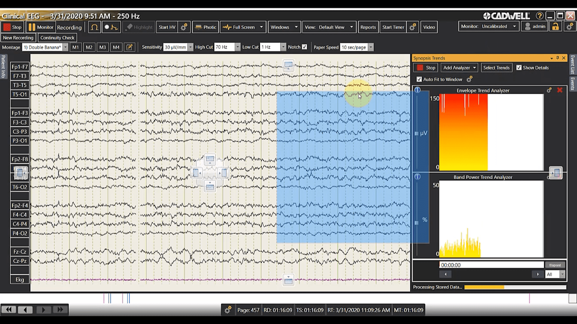 Managing Views and Windows
