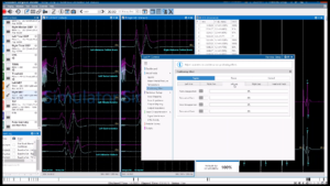 CadX Positioning Changes