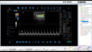 Ultrasound-Carotid Tutorial